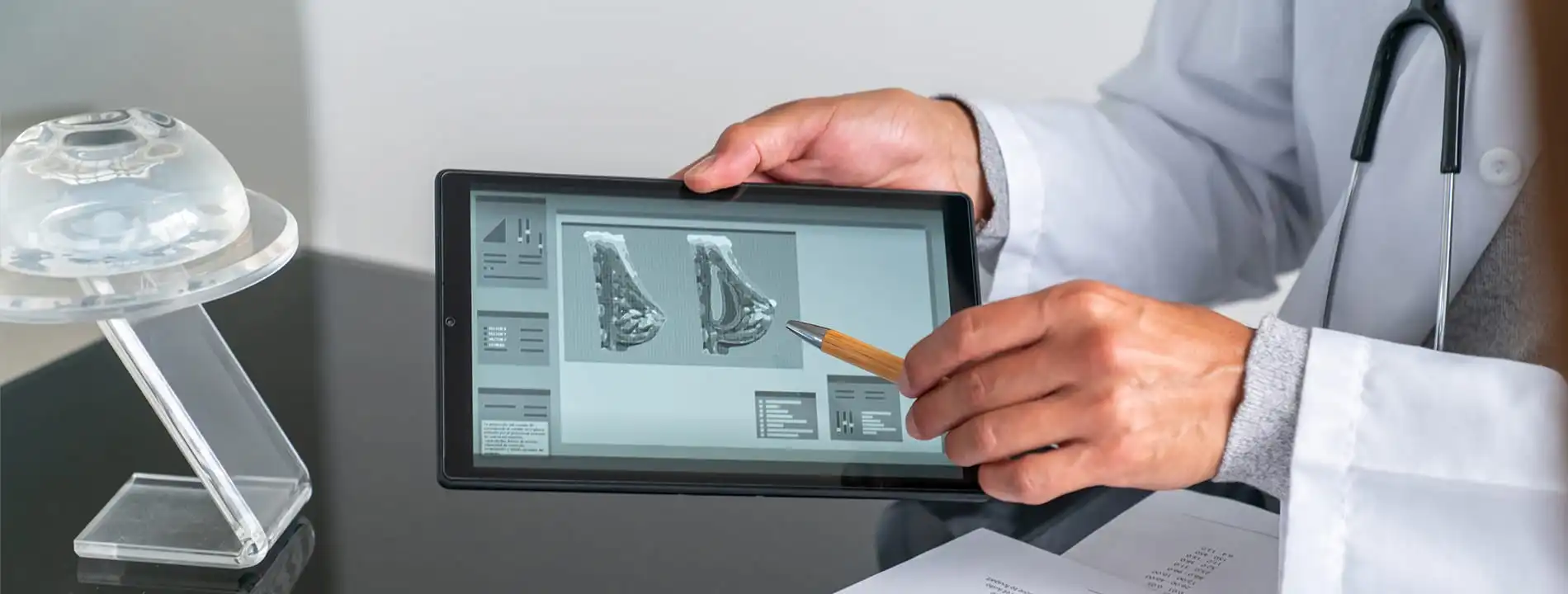 Surgeon pointing to breast implant imaging on tablet with silicone implant model visible
