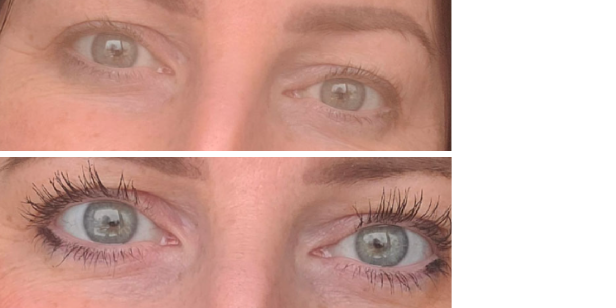 Before and after eye transformation showing enhanced lashes and improved eyelid contour